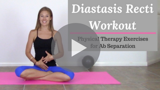 diastasis recti exercises