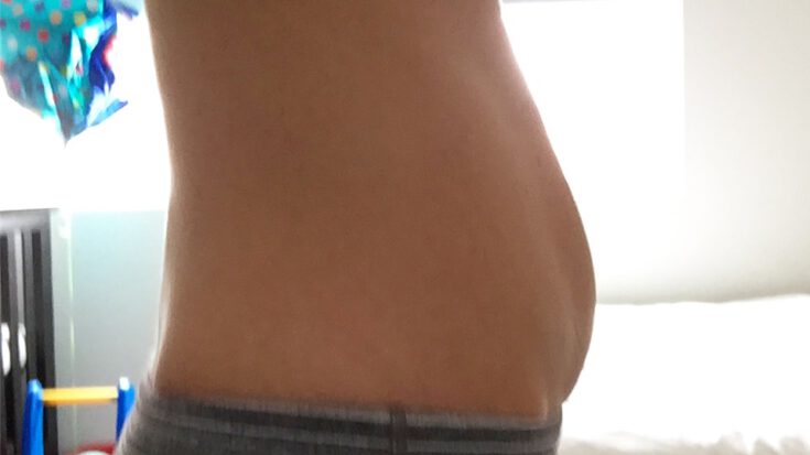 postpartum belly