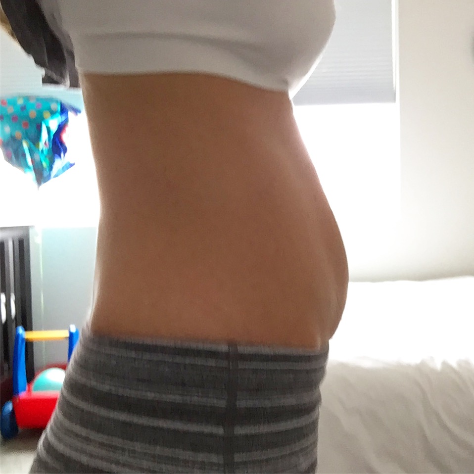 postpartum belly